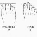РџСЏС‚РЅРёС‡РЅС‹Рµ РєРѕРјРёРєСЃС‹ (125 С„РѕС‚Рѕ)