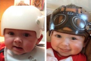 Required baby helmets become a great accessory thanks to a little art