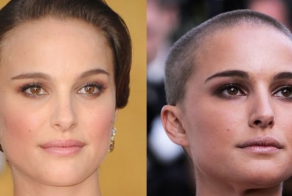 Celebs with and without hair is no subtle difference