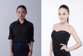 Plastic surgery is all the rage in China