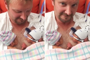 Premature Twins Holding Hands Take Internet By Storm