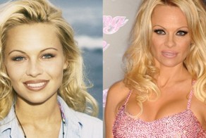 12 Celebrities Who Looked Better Before Going Under The Knife