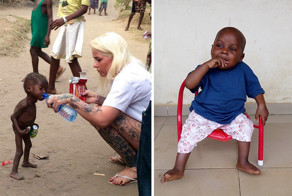 2-Year-Old ‘Witch Child’ Who Was Left To Die Makes Stunning Recovery