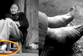 These Are The Last Women With Bound Feet In China