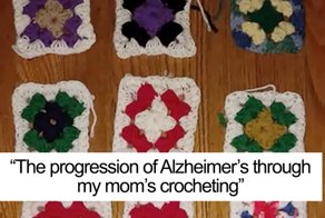 Daughter Shows What Alzheimer’s Did To Her Mother Over 2 Years
