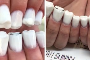 Teeth-Nails Exist, And If You Think They Can’t Get Any Worse, Watch This Video