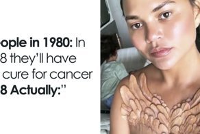 Celebrities Are Getting Temporary Skin “Implants” And It’s Freaking People Out