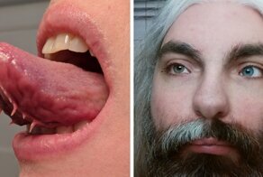 40 People With Unique And Rare Body Features