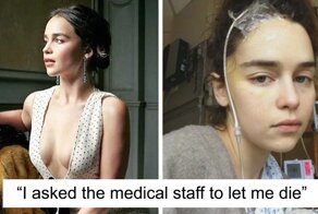 Emilia Clarke Shares 5 Never-Before-Seen Photos From Hospital After Having Two Aneurysms