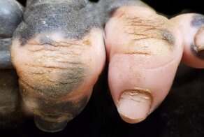 A Gorilla Born With A Lack Of Pigmentation On Her Fingers Surprises People