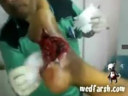 Ужасное зрелище