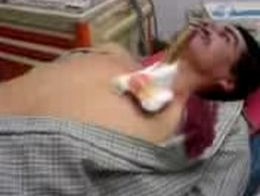 Неудачный суицид