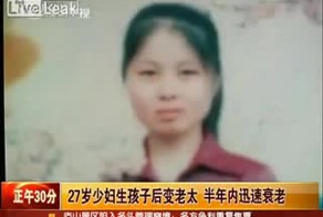 Гормональный сбой