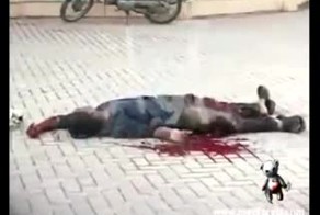 Прострелили ногу