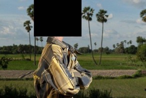 Редкое заболевание превратило мальчика в пенсионера (6 фото)