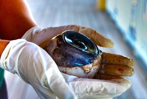 В США на один из пляжей выбросило огромный глаз ( 10 фото + видео)