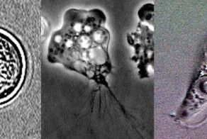 4 паразита, готовые в любой момент вторгнуться в мозг