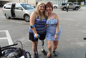 «Живая статуя» продолжает бороться со страшной болезнью