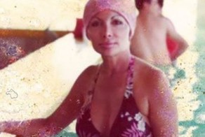 "Домохозяйка Майями" переборщила с пластикой