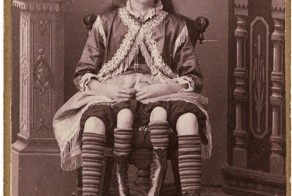 Уродцы Викторианской эпохи