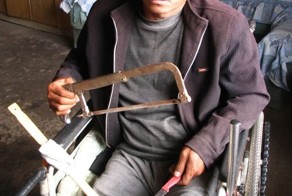 Китаец самостоятельно ампутировал себе ногу