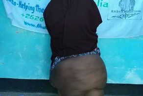 Жненщина с ногой весом в 35 кг!