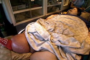 Как сбросить 350 кг - опыт бывалой женщины