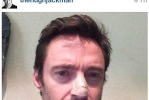 Росомаха, успешной тебе регенерации!