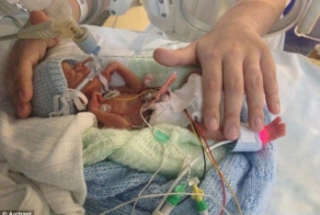 Младенец весом в 500 грамм победил смерть