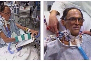 Почему у американца Крэйга Льюиса нет пульса?