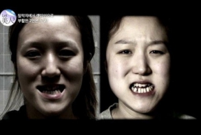 Преображение южнокорейских близнецов