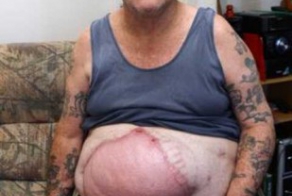 Пенсионер пытается изгнать "Нечто", пробравшееся к нему в живот