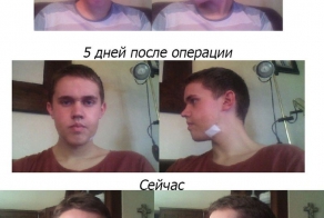 Пластическая хирургия в действии