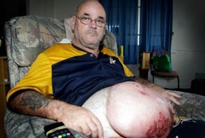 Последствия глотка пива из грязной банки