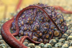 Рак крупным планом