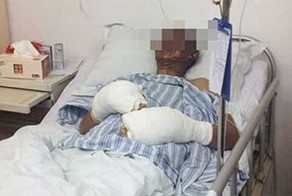 Китаец чуть не поджарил себя,когда раздевался