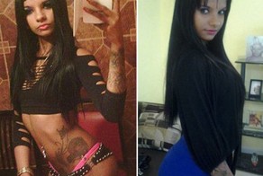 Девушка впала в кому после операции по увеличению груди