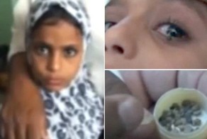 Девочка начала плакать камнями