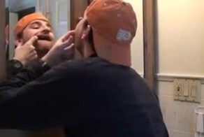 Сам себе вырвал зуб