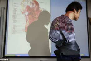 Хирурги срезали со спины китайца 10-килограммовый горб