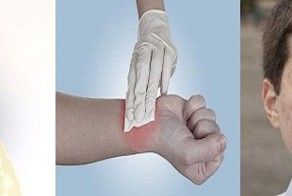 Студент изобрел чудо-гель, мгновенно заживляющий раны