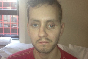 Медики распечатали жертве аварии новый череп