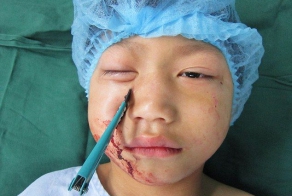 Не зря родители запрещают детям играть с ножницами