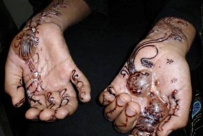 Чем чреваты временные татуировки хной