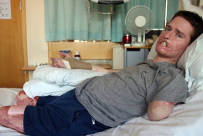 Плотоядные бактерии заживо поедают 34-летнего британца