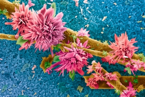 Завораживающие фотографии с премии Wellcome Image Award 2014