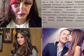 Московский олигарх изуродовал бросившую его модель
