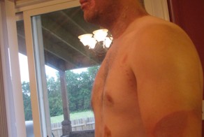 Последствия рыбалки со спиннингом в грозу