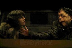 Тяжёлая судьба современного "Квазимодо"