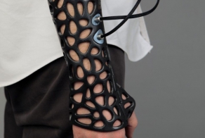 Сломали руку? — к черту гипс, вперёд 3D–печать